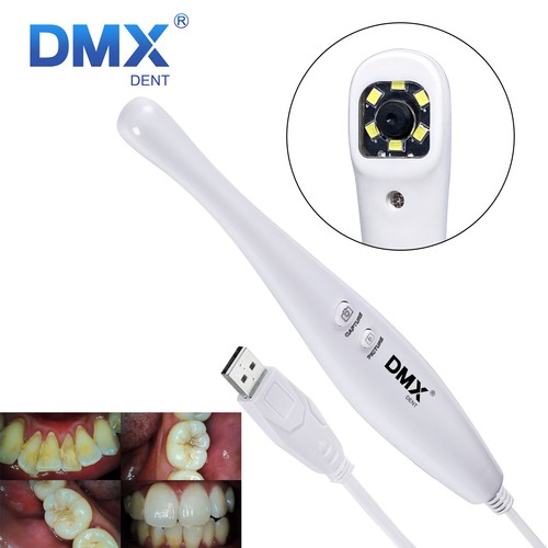 Fotocamera intraorale dentale